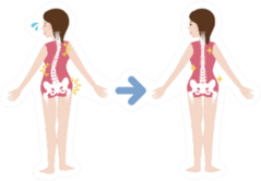 Chiropractic Before After Image Illustration Sticker