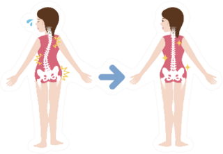 Chiropractic Before After Image Illustration Sticker