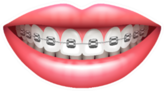 Teeth With Braces Beautiful Woman Smile Sticker