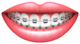 Teeth With Braces Beautiful Woman Smile Sticker