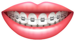 Teeth With Braces Beautiful Woman Smile Sticker